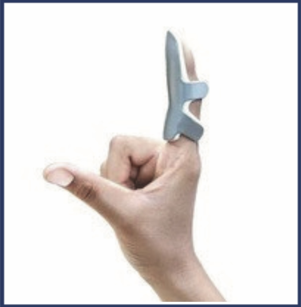 Frog Splint — Scanda Enterprises, medical supplies Moosapet Hyderabad